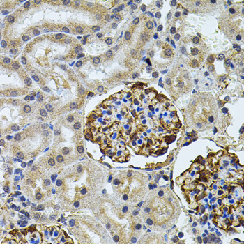 CETP Antibody - Immunohistochemistry of paraffin-embedded rat kidney using CETP antibody(40x lens).