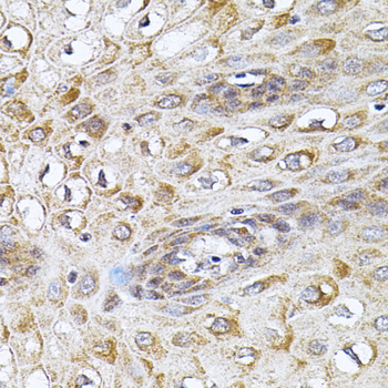 CETP Antibody - Immunohistochemistry of paraffin-embedded human esophagus using CETP antibody(40x lens).