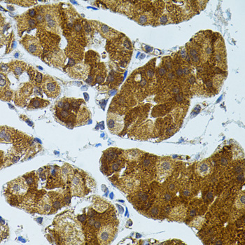 CETP Antibody - Immunohistochemistry of paraffin-embedded human stomach using CETP antibody(40x lens).