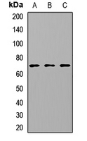 CETP Antibody - Western blot analysis of CETP _expression in Hela (A), Jurkat (B), HepG2 (C) whole cell lysates.