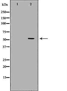 CETP Antibody - Western blot analysis of HeLa whole cells lysates using CETP antibody. The lane on the left is treated with the antigen-specific peptide.