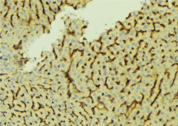CETP Antibody - 1:100 staining mouse liver tissue by IHC-P. The sample was formaldehyde fixed and a heat mediated antigen retrieval step in citrate buffer was performed. The sample was then blocked and incubated with the antibody for 1.5 hours at 22°C. An HRP conjugated goat anti-rabbit antibody was used as the secondary.