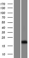 CFAP126 / C1orf192 Protein - Western validation with an anti-DDK antibody * L: Control HEK293 lysate R: Over-expression lysate