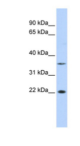 CFAP20 / GTL3 Antibody - C16orf80 / GTL3 antibody Western blot of Placenta lysate. This image was taken for the unconjugated form of this product. Other forms have not been tested.