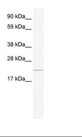 CFAP20 / GTL3 Antibody - Placenta Lysate.  This image was taken for the unconjugated form of this product. Other forms have not been tested.