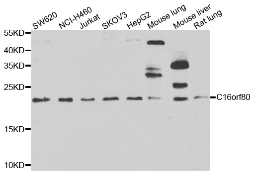 CFAP20 / GTL3 Antibody - Western blot analysis of extracts of various cell lines.