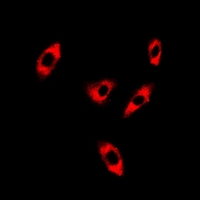 CFAP20 / GTL3 Antibody - Immunofluorescent analysis of GTL3 staining in A549 cells. Formalin-fixed cells were permeabilized with 0.1% Triton X-100 in TBS for 5-10 minutes and blocked with 3% BSA-PBS for 30 minutes at room temperature. Cells were probed with the primary antibody in 3% BSA-PBS and incubated overnight at 4 deg C in a humidified chamber. Cells were washed with PBST and incubated with a DyLight 594-conjugated secondary antibody (red) in PBS at room temperature in the dark.