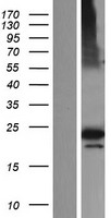 CFAP20 / GTL3 Protein - Western validation with an anti-DDK antibody * L: Control HEK293 lysate R: Over-expression lysate