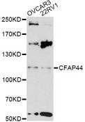 CFAP44 / WDR52 Antibody - Western blot analysis of extracts of various cell lines, using CFAP44 antibody at 1:3000 dilution. The secondary antibody used was an HRP Goat Anti-Rabbit IgG (H+L) at 1:10000 dilution. Lysates were loaded 25ug per lane and 3% nonfat dry milk in TBST was used for blocking. An ECL Kit was used for detection and the exposure time was 90s.