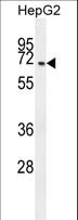 CFAP45 / CCDC19 Antibody - CCDC19 Antibody western blot of HepG2 cell line lysates (35 ug/lane). The CCDC19 antibody detected the CCDC19 protein (arrow).