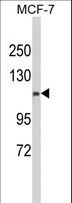 CFAP47 Antibody - Western blot of CXorf22 Antibody in MCF-7 cell line lysates (35 ug/lane). CXorf22 (arrow) was detected using the purified antibody.