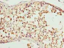 CFAP52 / WDR16 Antibody - Immunohistochemistry of paraffin-embedded human testis tissue using antibody at dilution of 1:100.