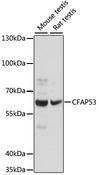 CFAP53 / CCDC11 Antibody - Western blot analysis of extracts of various cell lines using CFAP53 Polyclonal Antibody at dilution of 1:1000.