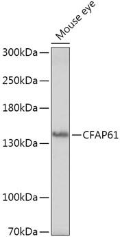 CFAP61 / C20orf26 Antibody - Western blot analysis of extracts of Mouse eye using CFAP61 Polyclonal Antibody at dilution of 1:1000.