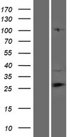 CFAP69 Protein - Western validation with an anti-DDK antibody * L: Control HEK293 lysate R: Over-expression lysate