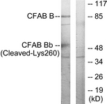 CFB / Complement Factor B Antibody - Western blot of extracts from K562 cells, treated with etoposide 25 uM 1h, using CFAB Bb (Cleaved-Lys260) Antibody. The lane on the right is treated with the synthesized peptide.