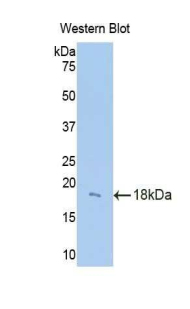 CFB / Complement Factor B Antibody - Western blot of recombinant CFB / Complement Factor B.  This image was taken for the unconjugated form of this product. Other forms have not been tested.