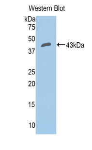 CFB / Complement Factor B Antibody - Western blot of recombinant CFB / Complement Factor B.  This image was taken for the unconjugated form of this product. Other forms have not been tested.