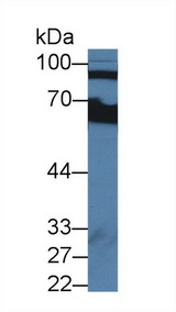 CFB / Complement Factor B Antibody - Western Blot; Sample: Human Serum; Primary Ab: 2µg/ml Rabbit Anti-Human CFB Antibody Second Ab: 0.2µg/mL HRP-Linked Caprine Anti-Rabbit IgG Polyclonal Antibody