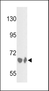 CFB / Complement Factor B Antibody - Western blot of BF Antibody in HepG2 cell line and mouse liver tissue lysates (35 ug/lane). BF (arrow) was detected using the purified antibody.