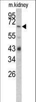 CFB / Complement Factor B Antibody - Western blot of CFB Antibody in mouse kidney tissue lysates (35 ug/lane). CFB (arrow) was detected using the purified antibody.