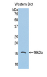 CFB / Complement Factor B Antibody - Western blot of recombinant CFB / Complement Factor B.  This image was taken for the unconjugated form of this product. Other forms have not been tested.