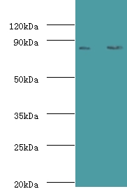 CFB / Complement Factor B Antibody - Western blot of Complement factor B antibody at 2 ug/ml lane 1: K562 whole cell lysate lane 2: HepG2 whole cell lysate. Secondary: Goat polyclonal to rabbit at 1:10000 dilution predicted band size: 86 KDa observed band size: 86 KDa.  This image was taken for the unconjugated form of this product. Other forms have not been tested.