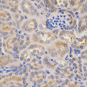 CFB / Complement Factor B Antibody - Immunohistochemistry of paraffin-embedded mouse kidney using CFB antibodyat dilution of 1:200 (40x lens).