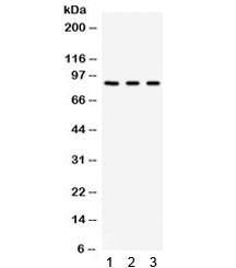 CFB / Complement Factor B Antibody