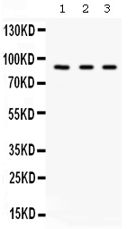 CFB / Complement Factor B Antibody - Western blot - Anti-Factor B Picoband Antibody