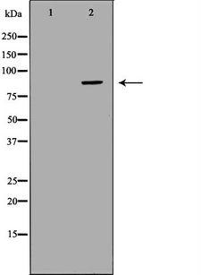 CFB / Complement Factor B Antibody - Western blot analysis of HepG2 whole cells lysates using CFB antibody. The lane on the left is treated with the antigen-specific peptide.