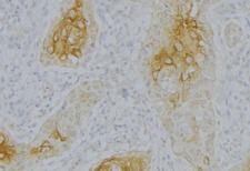 CFB / Complement Factor B Antibody - 1:100 staining human uterus tissue by IHC-P. The sample was formaldehyde fixed and a heat mediated antigen retrieval step in citrate buffer was performed. The sample was then blocked and incubated with the antibody for 1.5 hours at 22°C. An HRP conjugated goat anti-rabbit antibody was used as the secondary.