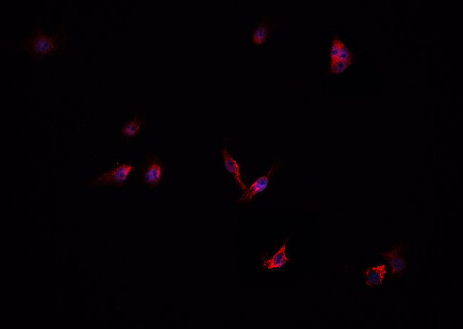 CFB / Complement Factor B Antibody - Staining HepG2 cells by IF/ICC. The samples were fixed with PFA and permeabilized in 0.1% Triton X-100, then blocked in 10% serum for 45 min at 25°C. The primary antibody was diluted at 1:200 and incubated with the sample for 1 hour at 37°C. An Alexa Fluor 594 conjugated goat anti-rabbit IgG (H+L) antibody, diluted at 1/600, was used as secondary antibody.