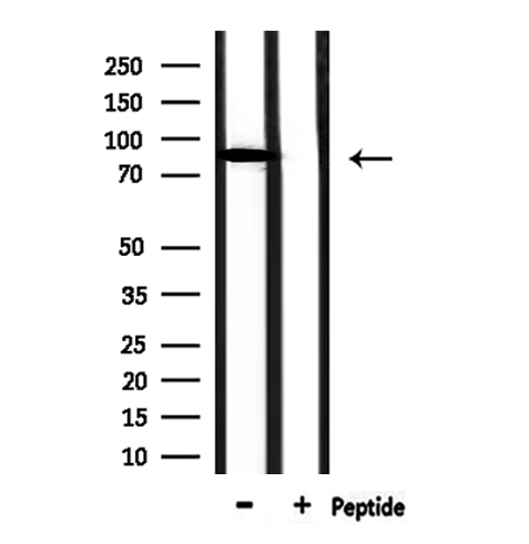 CFB / Complement Factor B Antibody - Western blot analysis of extracts of mouse brain tissue using CFB antibody.