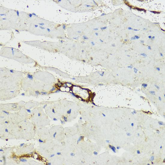 CFB / Complement Factor B Antibody - Immunohistochemistry of paraffin-embedded Mouse heart using Complement Factor B Polyclonal Antibody at dilution of 1:200 (40x lens).