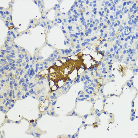 CFB / Complement Factor B Antibody - Immunohistochemistry of paraffin-embedded Mouse lung using Complement Factor B Polyclonal Antibody at dilution of 1:200 (40x lens).