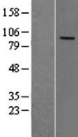 CFB / Complement Factor B Protein - Western validation with an anti-DDK antibody * L: Control HEK293 lysate R: Over-expression lysate