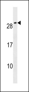 CFC1B Antibody - CFC1B Antibody western blot of NCI-H292 cell line lysates (35 ug/lane). The CFC1B antibody detected the CFC1B protein (arrow).