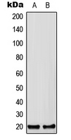 CFC1B Antibody - Western blot analysis of CFC1B expression in HEK293T (A); Raw264.7 (B); H9C2 (C) whole cell lysates.