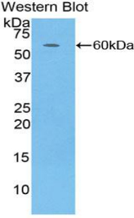 CFD / Factor D / Adipsin Antibody - Western blot of recombinant CFD / Factor D / Adipsin.  This image was taken for the unconjugated form of this product. Other forms have not been tested.