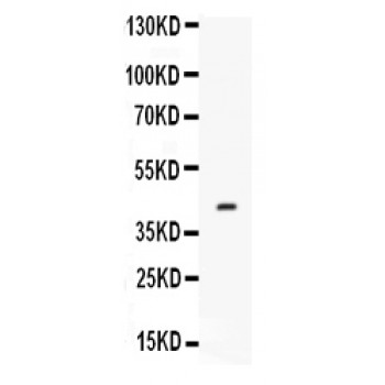 CFD / Factor D / Adipsin Antibody - Western blot analysis of Factor D expression in mouse spleen extract (lane 1). Factor D at 43 kD was detected using rabbit anti- Factor D Antigen Affinity purified polyclonal antibody at 0.5 ug/mL. The blot was developed using chemiluminescence (ECL) method.