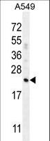 CFD / Factor D / Adipsin Antibody - CFD Antibody western blot of A549 cell line lysates (35 ug/lane). The CFD antibody detected the CFD protein (arrow).