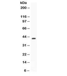 CFD / Factor D / Adipsin Antibody