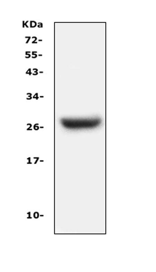 CFD / Factor D / Adipsin Antibody - Western blot analysis of Factor D using anti-Factor D antibody. Electrophoresis was performed on a 5-20% SDS-PAGE gel at 70V (Stacking gel) / 90V (Resolving gel) for 2-3 hours. The sample well of each lane was loaded with 50ug of sample under reducing conditions. Lane 1: mouse lung tissue lysates, After Electrophoresis, proteins were transferred to a Nitrocellulose membrane at 150mA for 50-90 minutes. Blocked the membrane with 5% Non-fat Milk/ TBS for 1.5 hour at RT. The membrane was incubated with rabbit anti-Factor D antigen affinity purified polyclonal antibody at 0.5 µg/mL overnight at 4°C, then washed with TBS-0.1% Tween 3 times with 5 minutes each and probed with a goat anti-rabbit IgG-HRP secondary antibody at a dilution of 1:10000 for 1.5 hour at RT. The signal is developed using an Enhanced Chemiluminescent detection (ECL) kit with Tanon 5200 system. A specific band was detected for Factor D at approximately 27KD. The expected band size for Factor D is at 27KD.