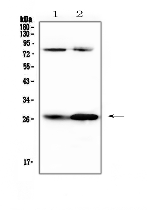 CFD / Factor D / Adipsin Antibody - Western blot analysis of Factor D using anti-Factor D antibody. Electrophoresis was performed on a 5-20% SDS-PAGE gel at 70V (Stacking gel) / 90V (Resolving gel) for 2-3 hours. The sample well of each lane was loaded with 50ug of sample under reducing conditions. Lane 1: rat RH35 cell lysates, Lane 2: rat PC-12 cell lysates. After Electrophoresis, proteins were transferred to a Nitrocellulose membrane at 150mA for 50-90 minutes. Blocked the membrane with 5% Non-fat Milk/ TBS for 1.5 hour at RT. The membrane was incubated with rabbit anti-Factor D antigen affinity purified polyclonal antibody at 0.5 µg/mL overnight at 4°C, then washed with TBS-0.1% Tween 3 times with 5 minutes each and probed with a goat anti-rabbit IgG-HRP secondary antibody at a dilution of 1:10000 for 1.5 hour at RT. The signal is developed using an Enhanced Chemiluminescent detection (ECL) kit with Tanon 5200 system. A specific band was detected for Factor D at approximately 27KD. The expected band size for Factor D is at 27KD.