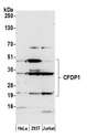 CFDP1 Antibody - Detection of human CFDP1 by western blot. Samples: Whole cell lysate (50 µg) from HeLa, HEK293T, and Jurkat cells prepared using NETN lysis buffer. Antibody: Affinity purified rabbit anti-CFDP1 antibody used for WB at 1:1000. Detection: Chemiluminescence with an exposure time of 3 minutes.