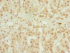 CFDP1 Antibody - Immunohistochemistry of paraffin-embedded human adrenal gland tissue at dilution 1:100