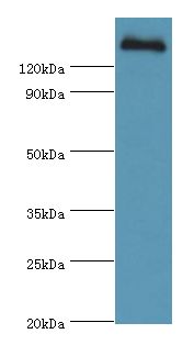 CFH / Complement Factor H Antibody - Western blot. All lanes: CFH antibody at 3 ug/ml+human serum. Secondary antibody: Goat polyclonal to rabbit at 1:10000 dilution. Predicted band size: 139 kDa. Observed band size: 139 kDa.