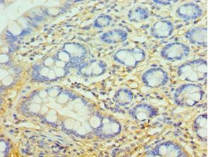 CFH / Complement Factor H Antibody - Immunohistochemistry of paraffin-embedded human small intestine tissue using antibody at 1:100 dilution.
