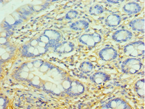 CFH / Complement Factor H Antibody - Immunohistochemistry of paraffin-embedded human small intestine tissue using CFH Antibody at dilution of 1:100